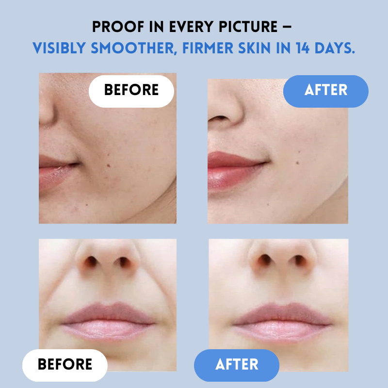 LumaLift™ — Instantly Revive Your Glow with a Featherlight, Youthful Lift