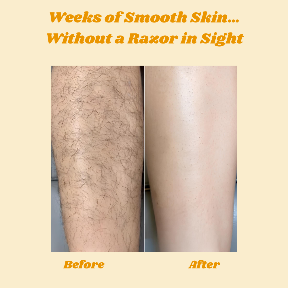HoneyMousse™ — Experience Pain-Free, Irresistibly Smooth Skin That Lasts Weeks