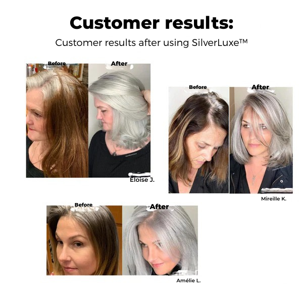 SilverMist™ — Unlock Luminous, Silky Silver Hair That Inspires Confidence Every Day