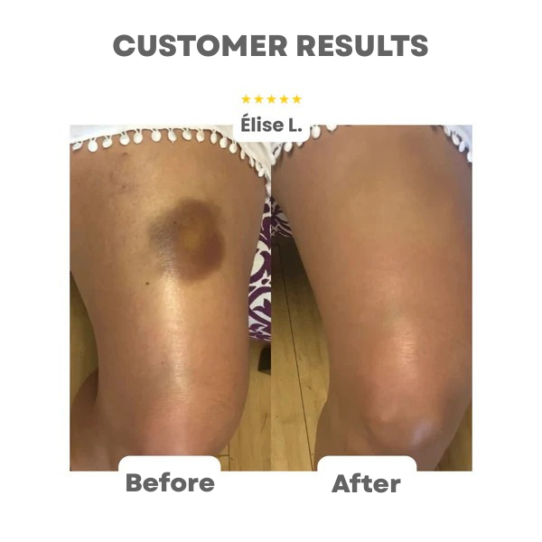 RadiantaBlur™ — Unlock Effortless, All-Day Radiance That Hides Flaws and Feels Like Skin