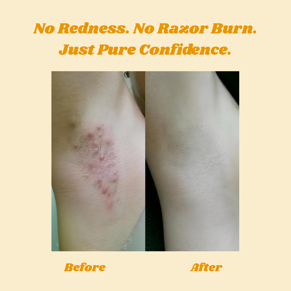 HoneyMousse™ — Experience Pain-Free, Irresistibly Smooth Skin That Lasts Weeks