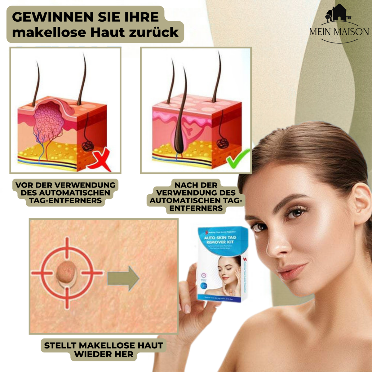 Wart & Mole Remover | Painless Non-Surgical Treatment | Skin-Friendly Formula | At-Home Use